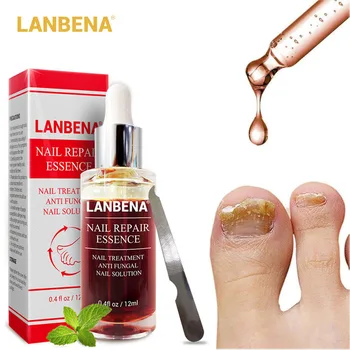 Грибковый popravak nokte эссенция serum njegu stopala uklanjanje gljivica noktiju gel protiv infekcija zanoktica onychomycosis LANBENA